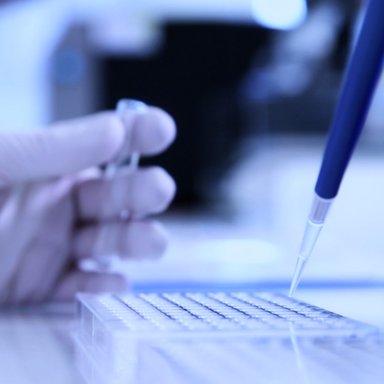 Photographie en gros plan d'une main gantée tenant une micropipette bleu foncé au-dessus d'une plaque de laboratoire à puits multiples.