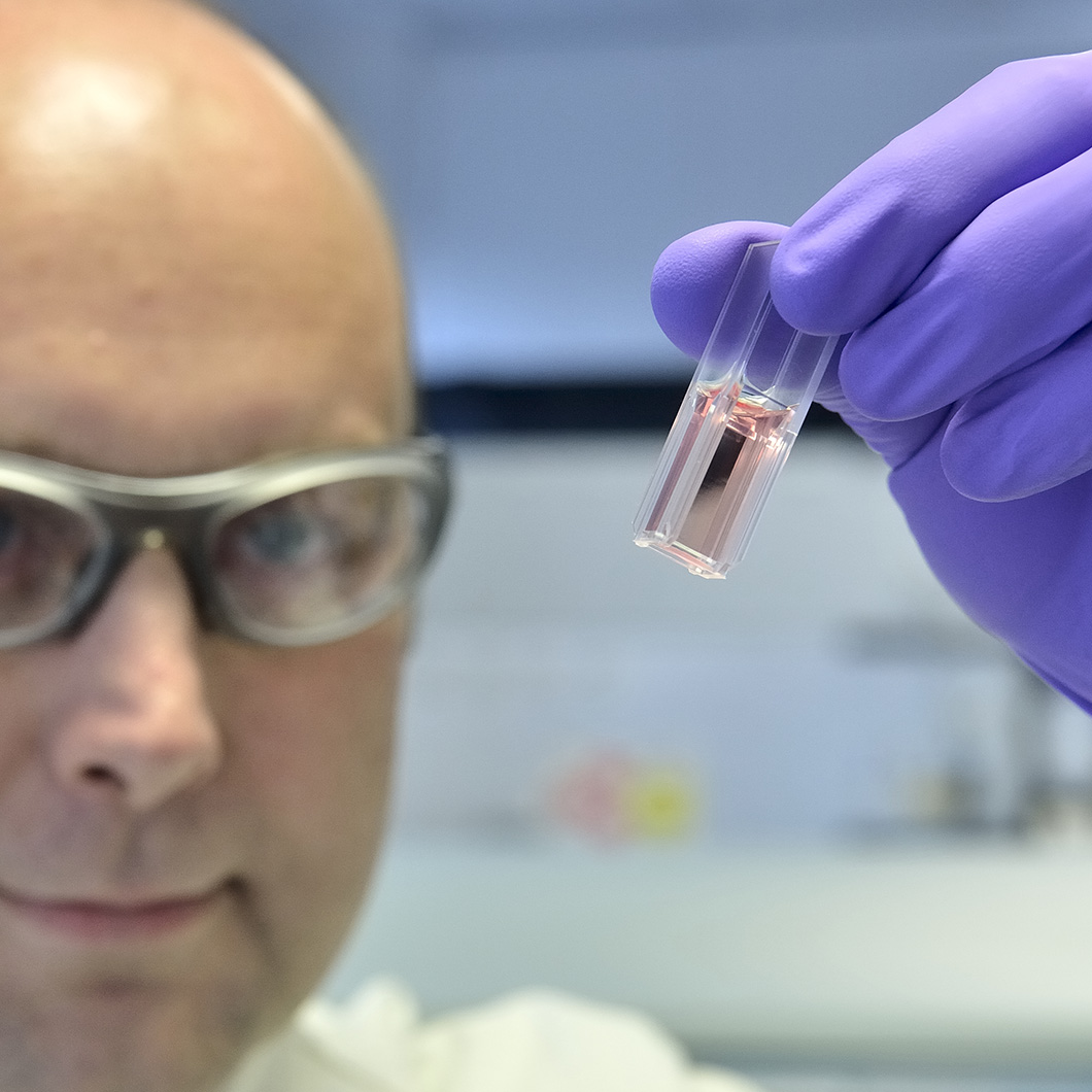 Photographie en gros plan d'un homme portant des lunettes examinant une cuvette contenant un liquide rosé, tenue par une main gantée de violet.